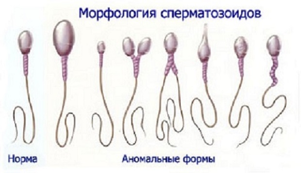 Морфология сперматозоидов